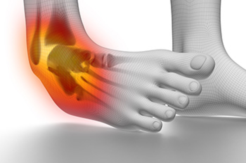Child's swollen ankle after a sports injury