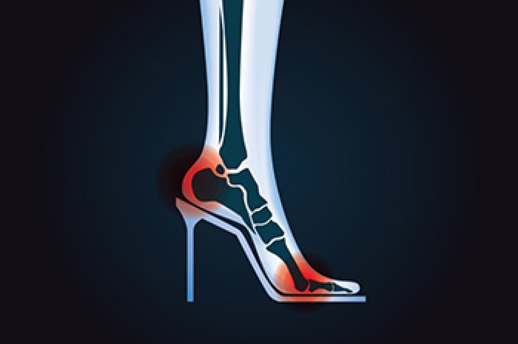 Feet in high heels showing pressure on the toes