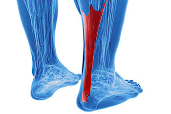 Achilles Tendonitis Treatment in Fleming Island, FL 32003 and Palm Coast, FL 32137