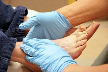 diabetic foot care in Fleming Island, FL 32003 and Palm Coast, FL 32137