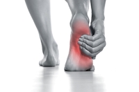 Causes of Arch Pain
