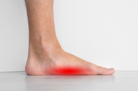 Symptoms and Treatment of Flat Feet