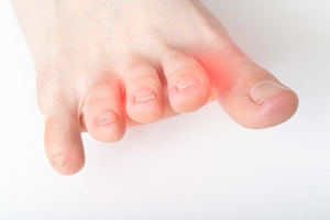 Why Do I Have Toe Pain?