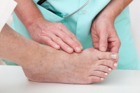 Surgery for Bunions