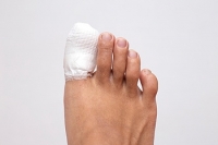 Is My Toe Mildly or Severely Fractured?